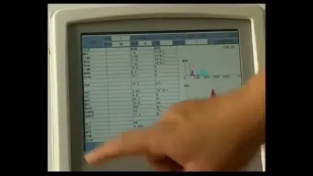 3부 자동 CBC 검사기 차등 혈액 세포 계수기 2개의 챔버가 있는 혈액학 분석기